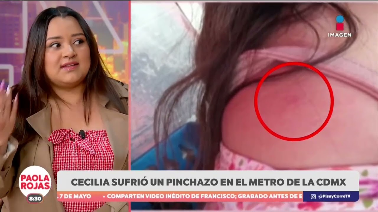 Usuaria del Metro de la CDMX narra el haber sufrido un pinchazo
