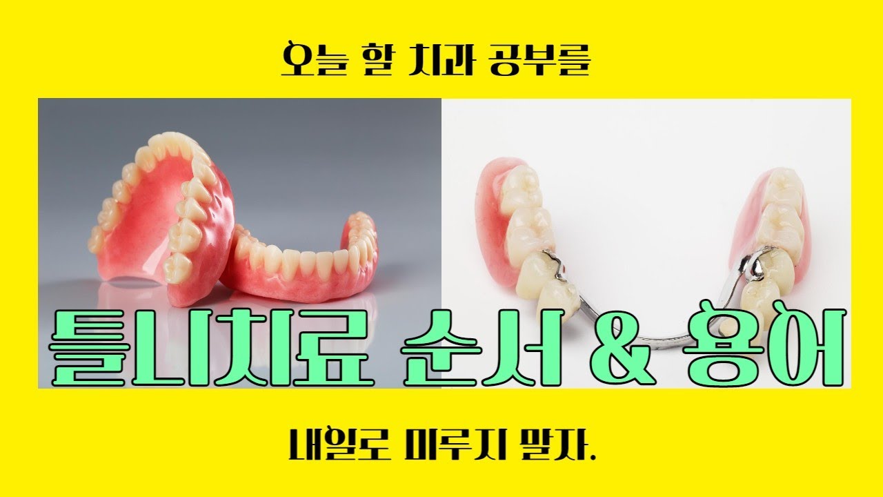틀니치료(완전이해/부분틀니/임플란트틀니)순서 및 용어