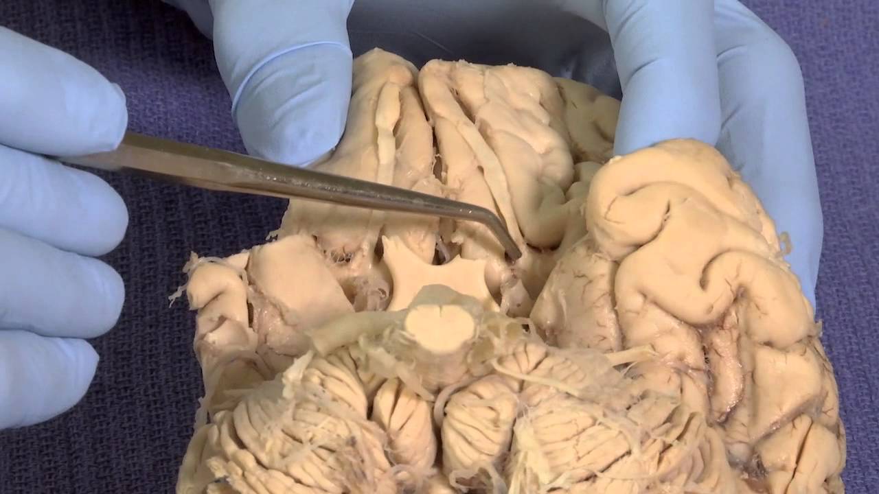 Olfactory: Neuroanatomy Video Lab - Brain Dissections