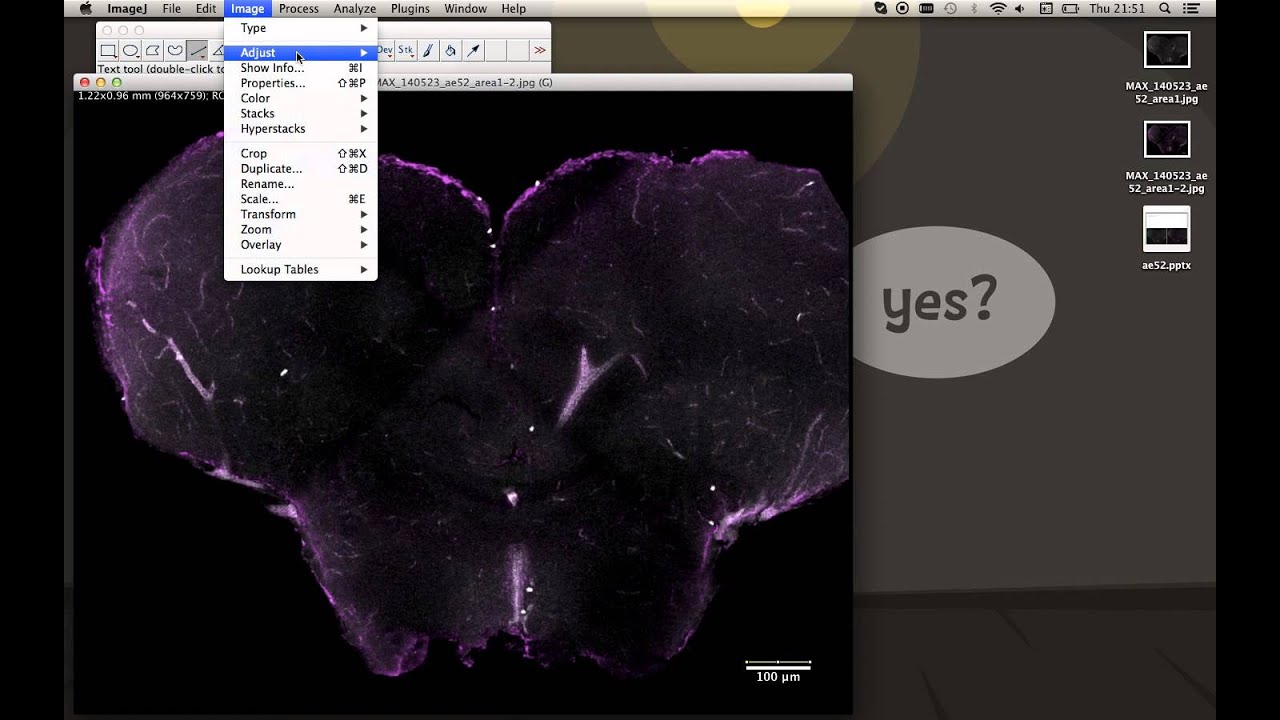 Calculate Area in ImageJ