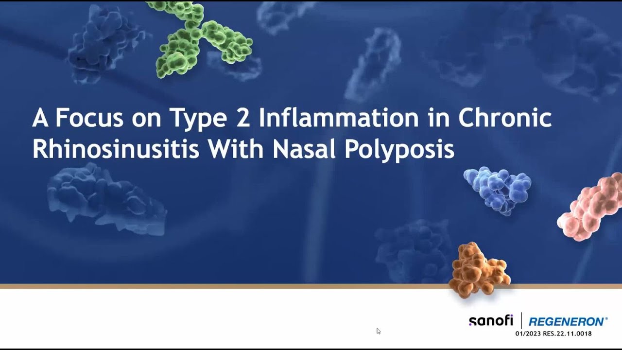 A Focus on Type 2 Inflammation in Chronic Rhinosinusitis With Nasal Polyposis
