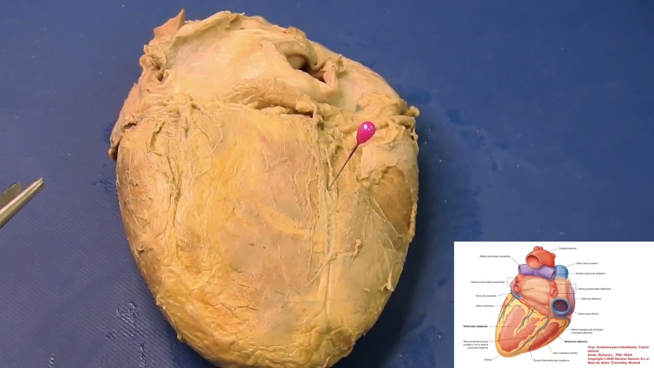 Morfología externa del corazón 2024VST