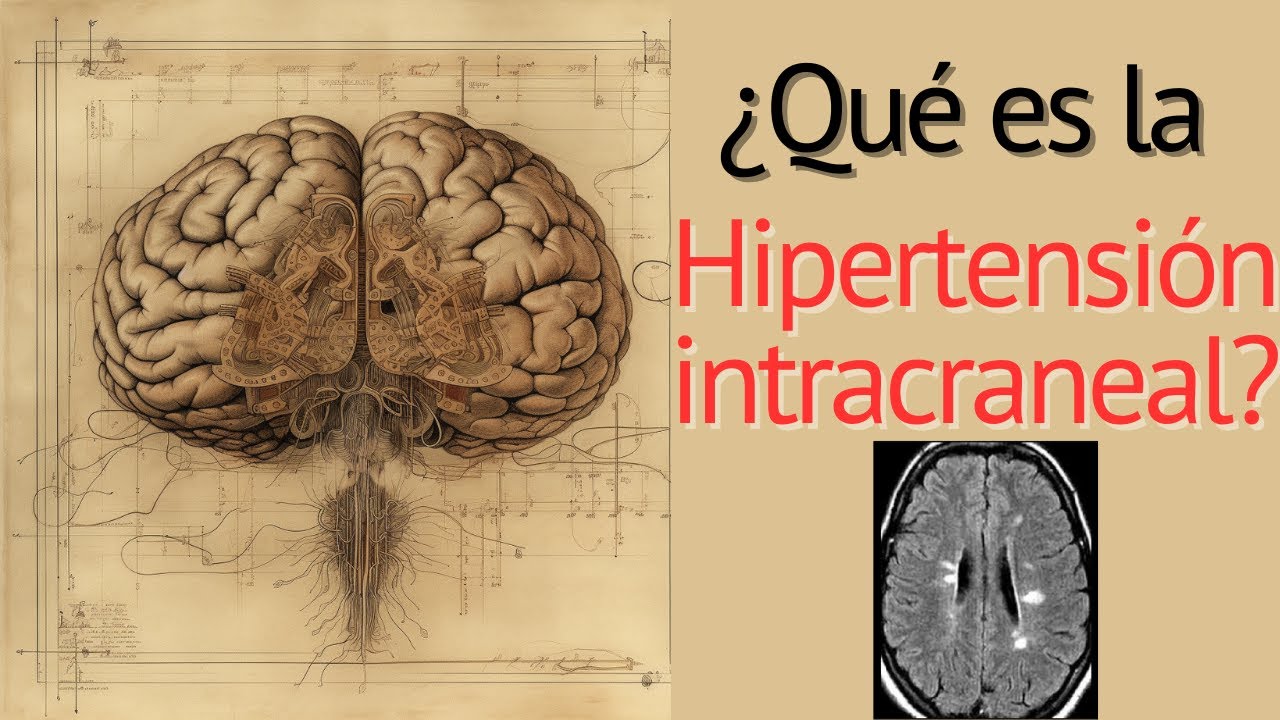 Hipertensión Intracraneal. Perlas