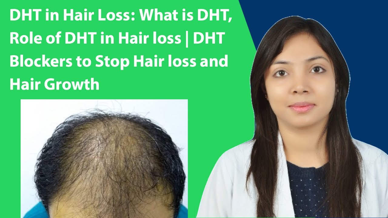DHT in Hair Loss: What is DHT, Role of DHT in Hair loss | DHT Blockers to Stop Hair loss
