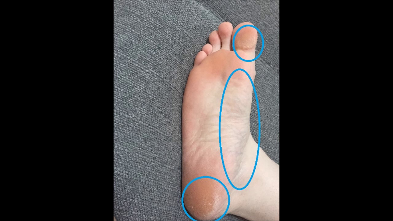Foot Reading Video July 14 2017