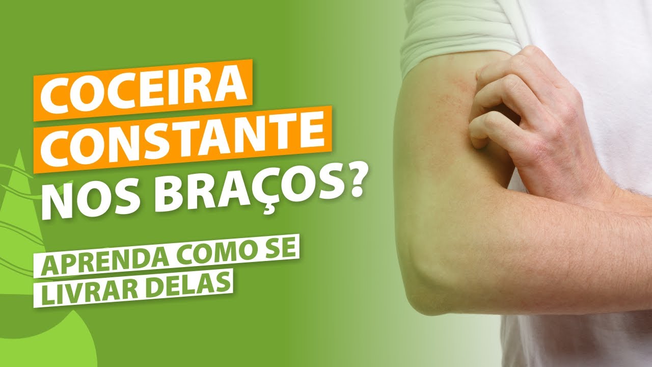 VOCÊ TEM COCEIRA PERSISTENTE NOS BRAÇOS E ANTEBRAÇOS? | Aprenda como se livrar dessa coceira.