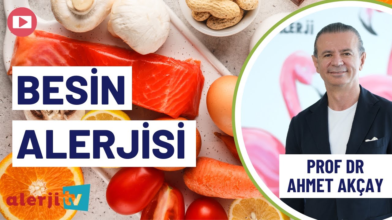 Besin Alerjisi Hakkında Merak Edilenler - Prof. Dr. Ahmet Akçay