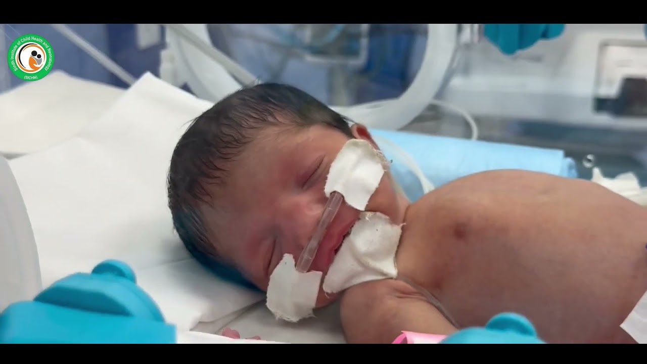 SICHN has established a 50-bedded NICU at Children's Hospital Larkana ground floor.