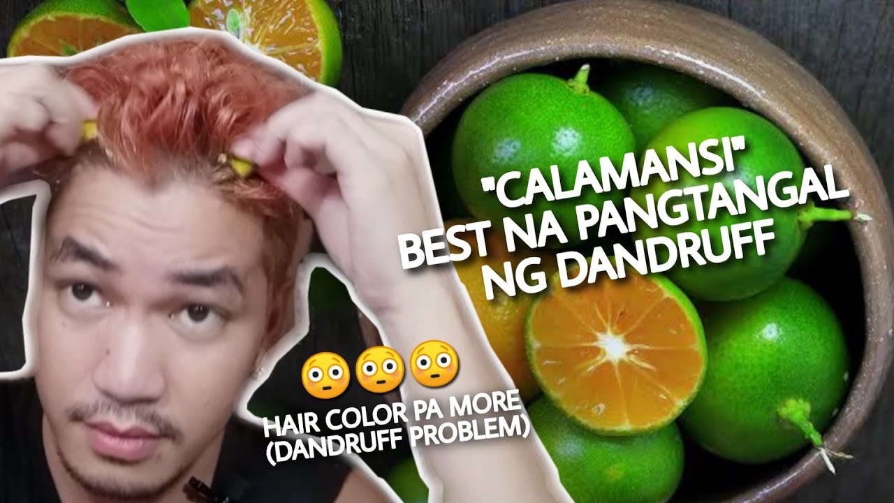 CALAMANSI Gamot sa DANDRUFF (