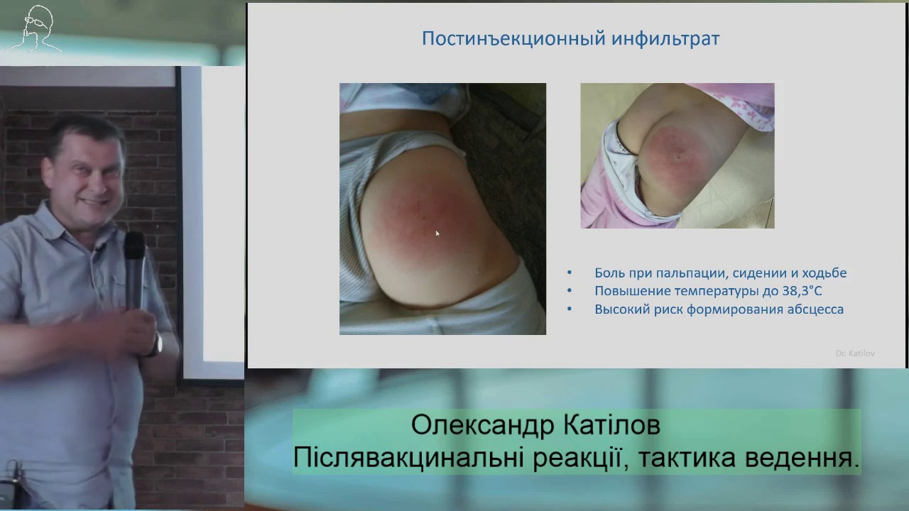 Післявакцинальні реакції, тактика ведення