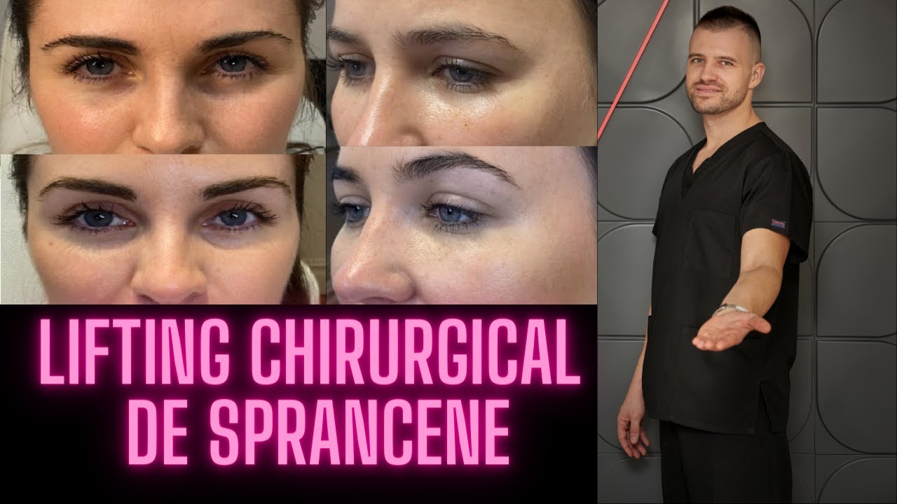 LIFTING Chirurgical de Sprancene