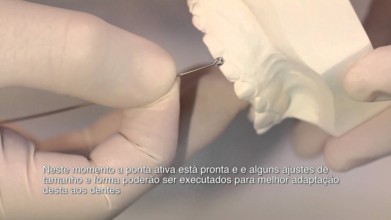 Grampo ortodôntico interproximal: técnica de confecção
