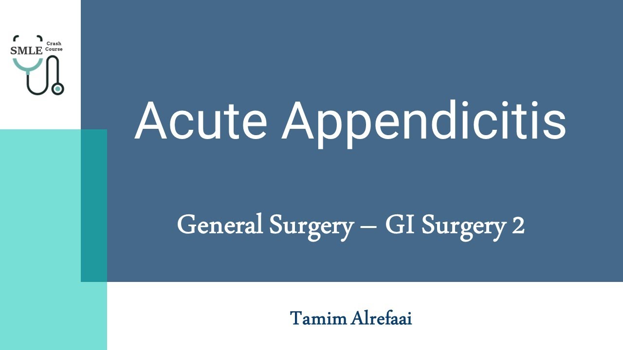 Acute Appendicitis - General Surgery || SMLE Crash Course