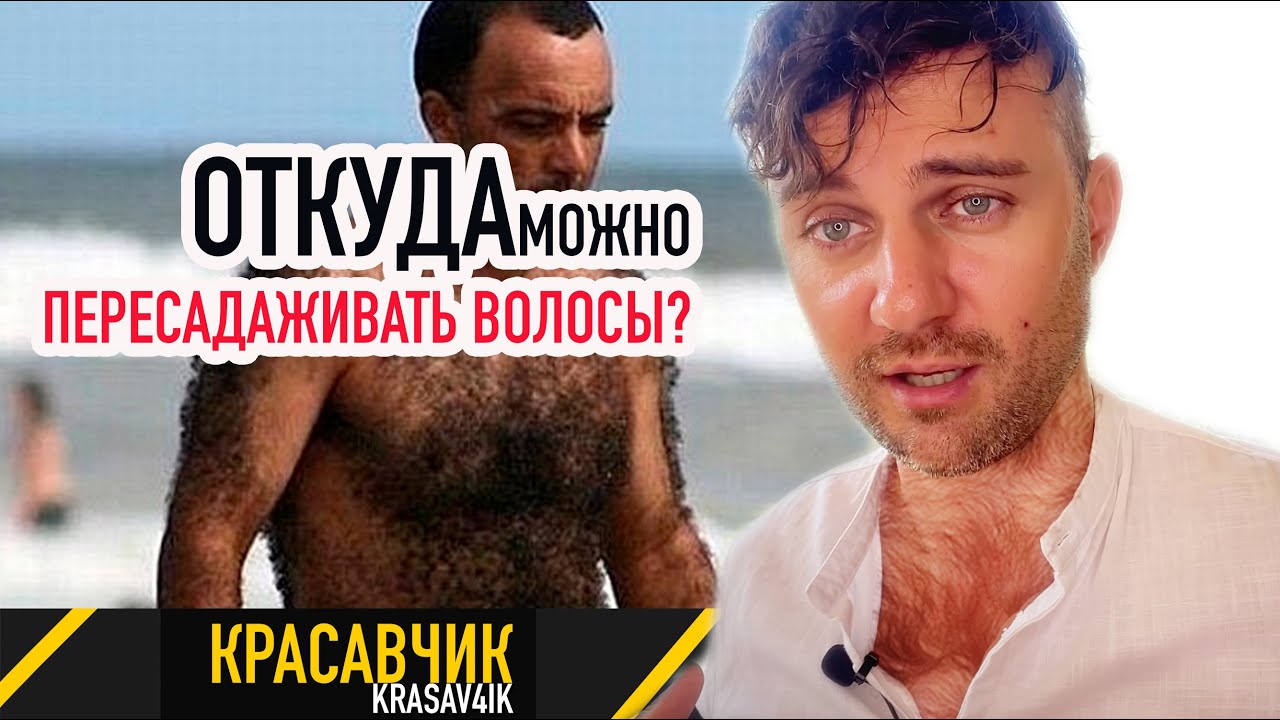 Вся правда о донорских зонах при пересадке волос \ Красавчик