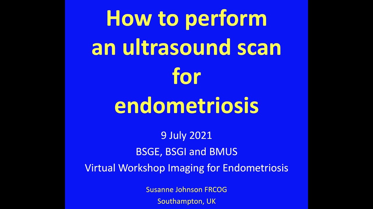'HOW TO PERFORM AN ULTRASOUND FOR ENDOMETRIOSIS'