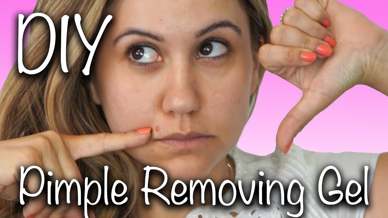 DIY Pimple Removing Gel