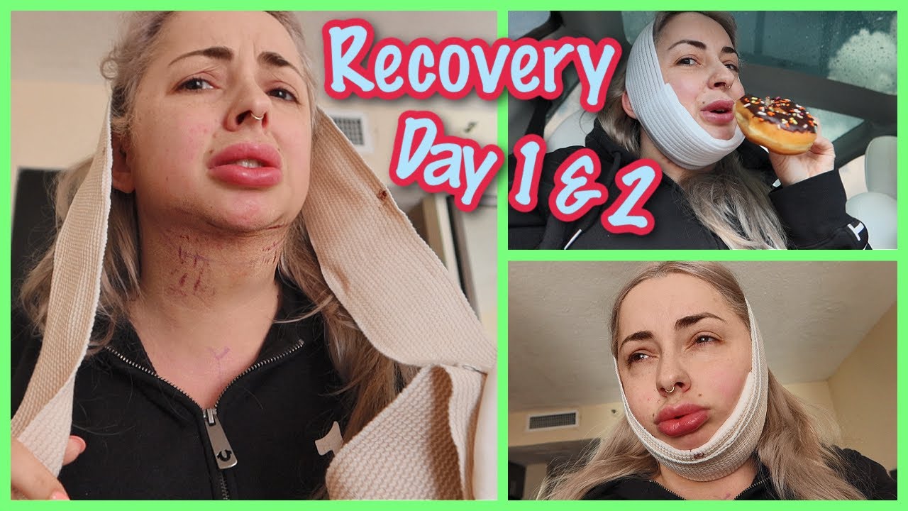 Recovering from surgery VLOG 🤍 DAYS 1 & 2 🤍