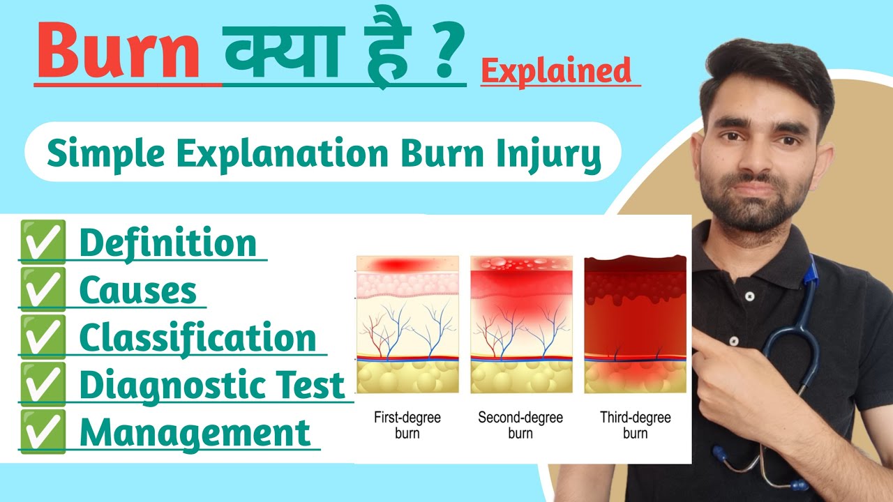 Burn Lecture in Hindi | Burn Lecture For Nursing Students | Causes And Classification of Burn