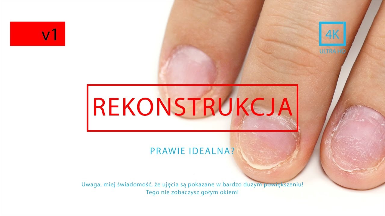 Quloo | Pokaz Rekonstrukcji Paznokcia! Tak blisko tego jeszcze nikt nie pokazał