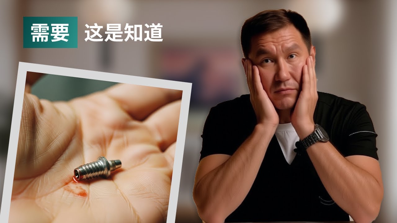 关于种植牙的全部真相——哪些人不适合，为什么它可能会脱落。这是2026年必须了解的内容