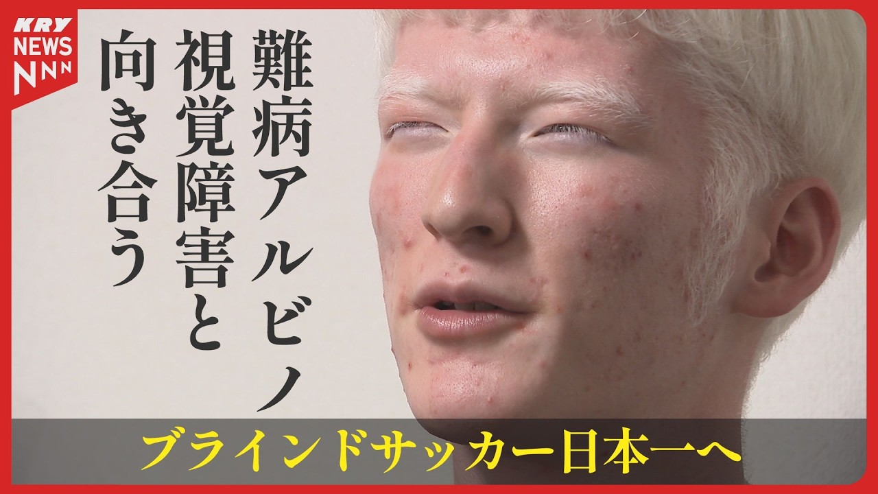 20歳 矢次祐汰の挑戦 ブラインドサッカー決勝の舞台／アルビノと視覚障害と向き合う｜山口県光市出身