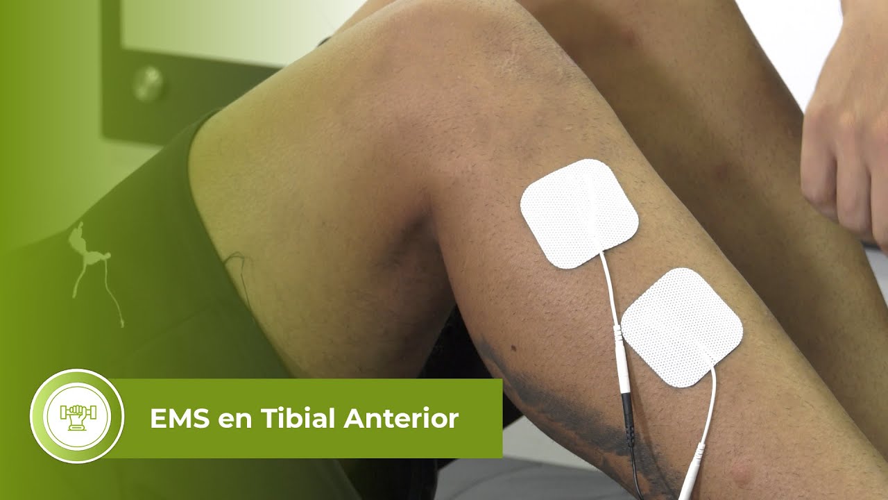 EMS en tibial anterior
