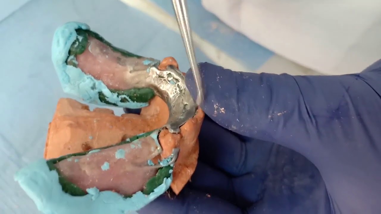 Altered cast