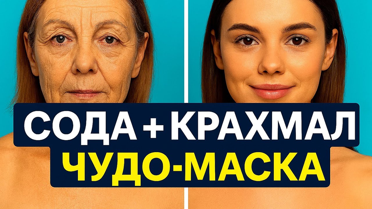СОДА + КРАХМАЛ в 70 лет СТЁРЛИ ВСЕ МОРЩИНЫ ! Маска для лица Рецепт
