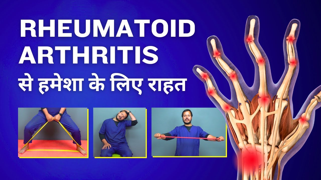 Rheumatoid Arthritis Pain Relief Exercises in Hindi - Knees, Hands, Legs, Toes - Physiotherapy