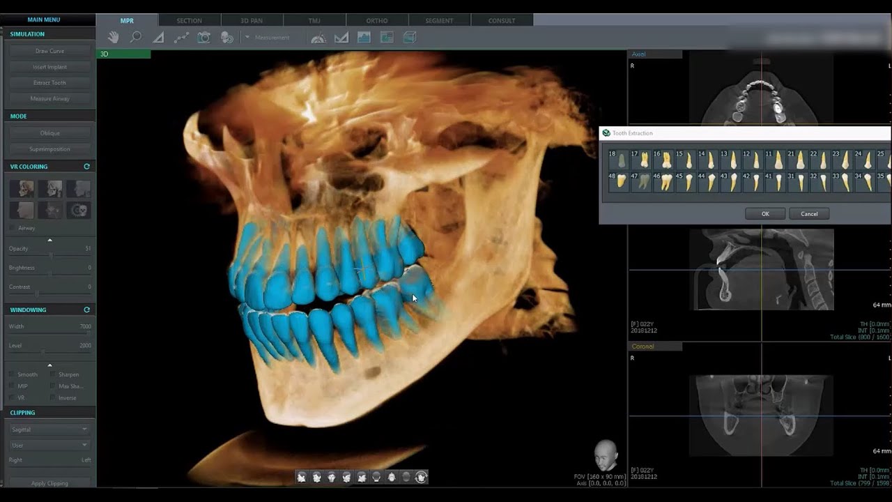 Ez3D-i 5.1 Teaser Video