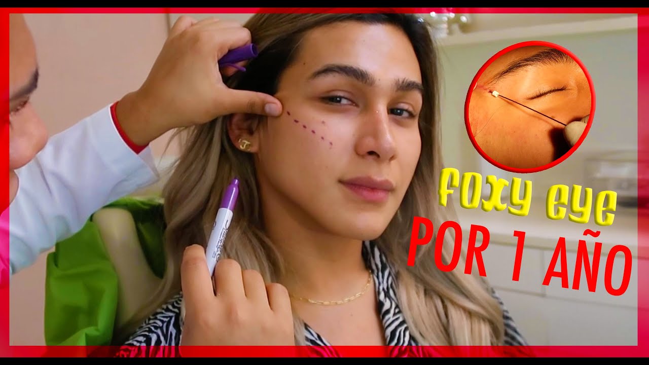 Me jale el rostro con HILOS TENSORES y esto pasó #foxyeye | Adicción al Labial