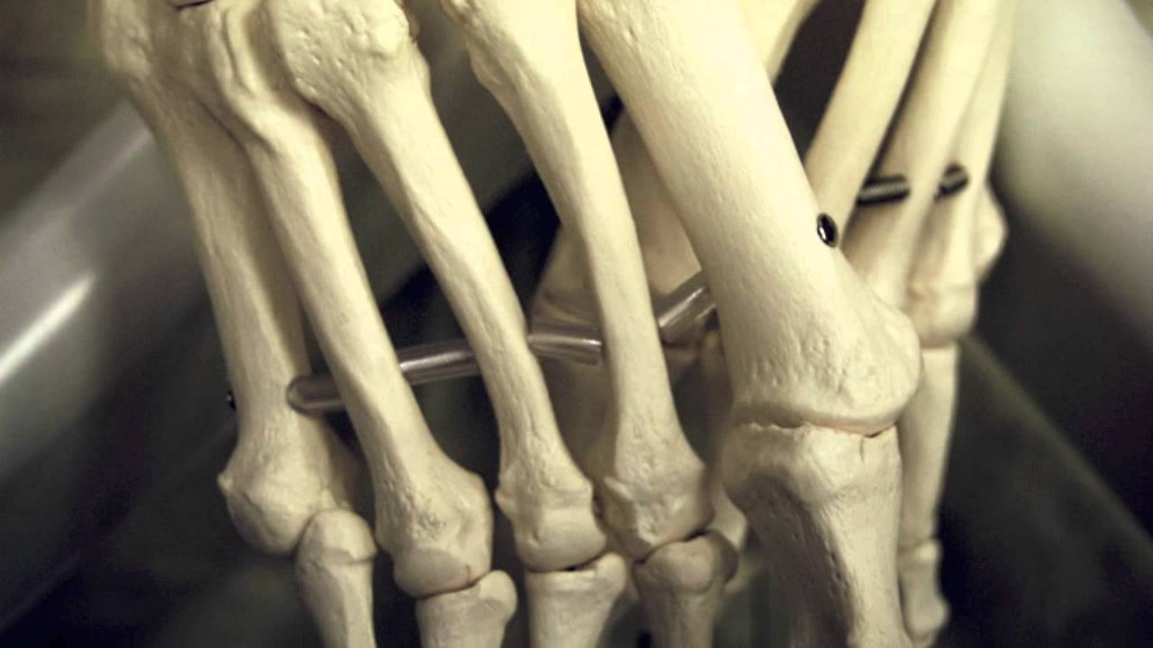 But You Don't Look Sick: Living With Chronic Pain (Ehlers Danlos Syndrome)