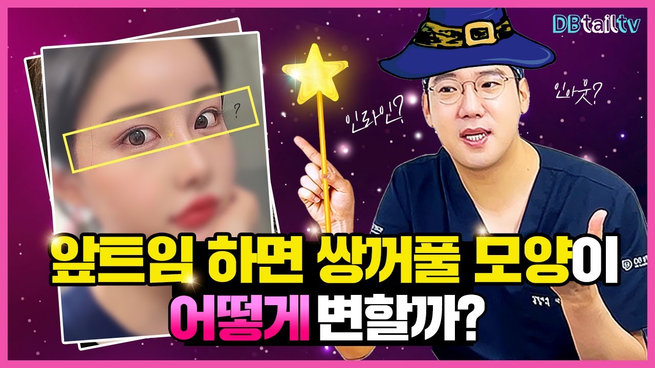 앞트임 하면 쌍꺼풀 모양이 어떻게 변할까?