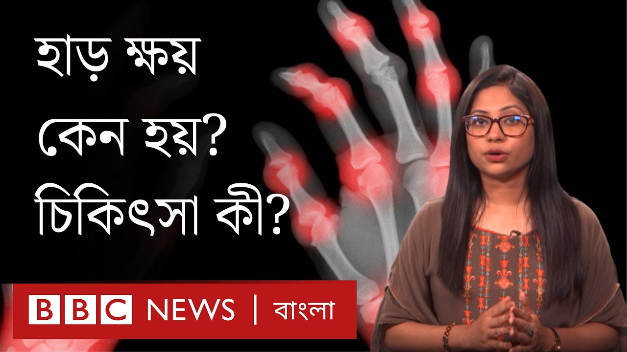Osteoporosis: হাড় ক্ষয় কেন হয়, সেরে ওঠার উপায় কী?