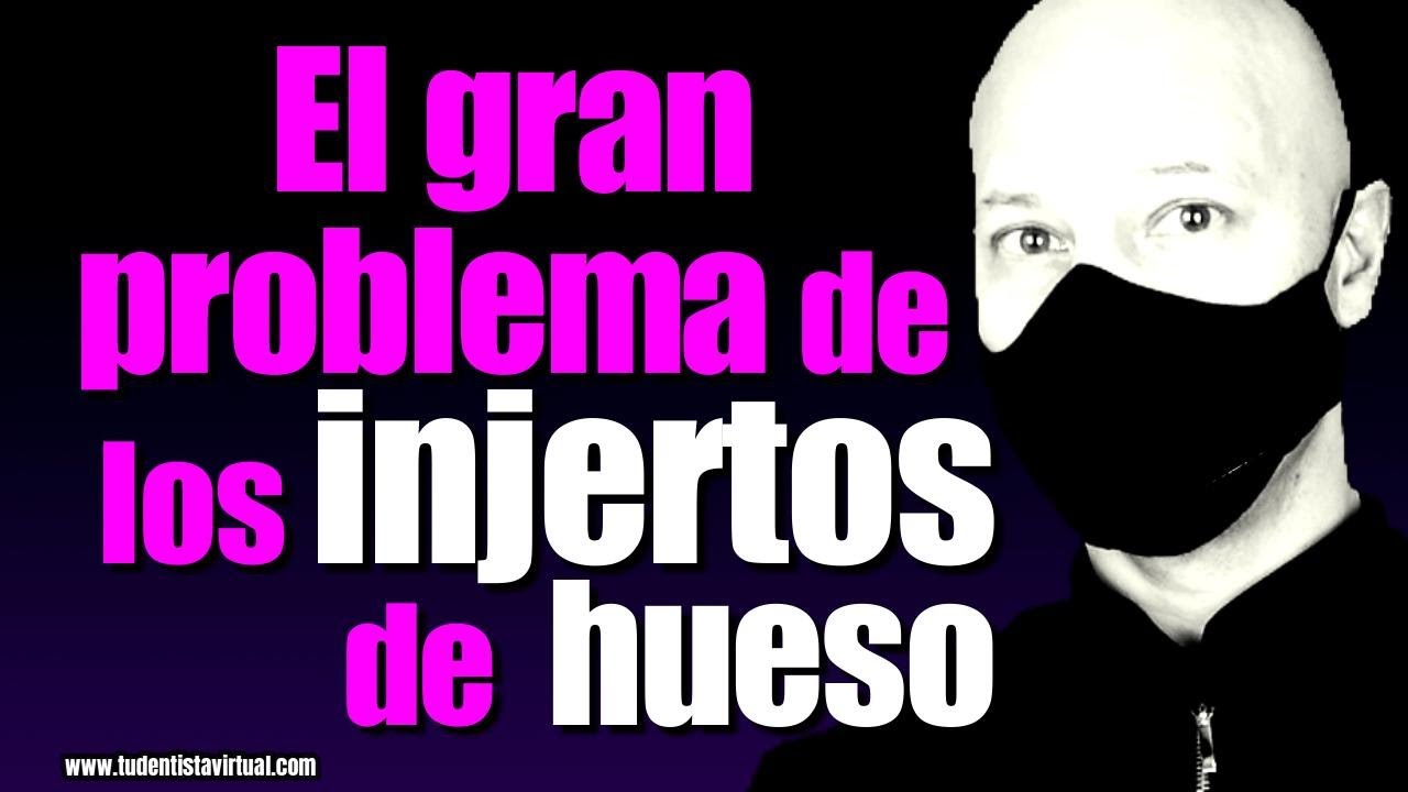 Que otra OPCIÓN hay para EVITAR los INJERTOS de HUESO