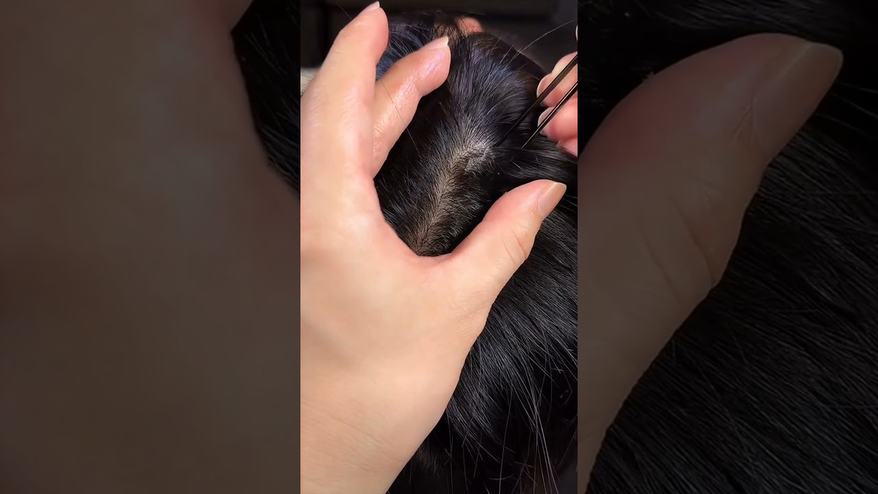 Dry Dandruff removing from hair scalp #dandruff #relaxing #haircare #satisfying #dandruffflakes