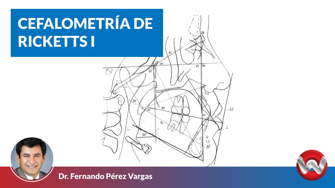 Cefalometría de Ricketts I