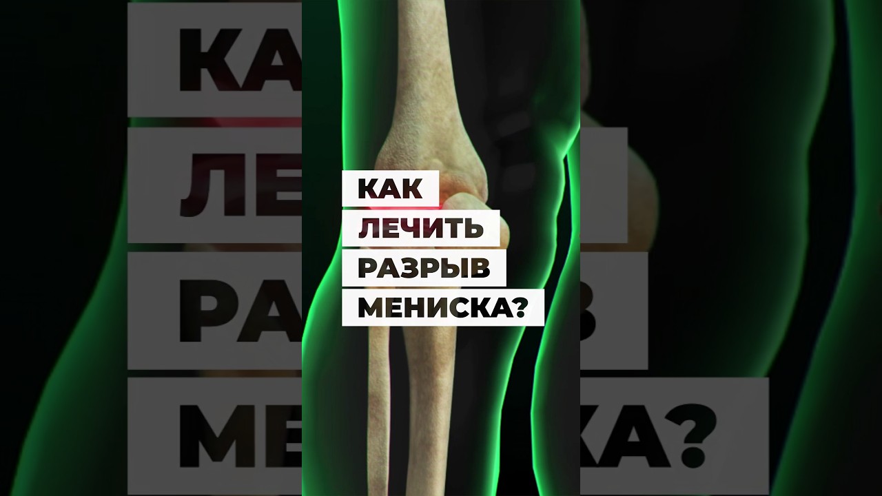 Как лечить разрыв мениска? #больвколенях  #мениск #разрывмениска #колени #болятколени #травмыколеней