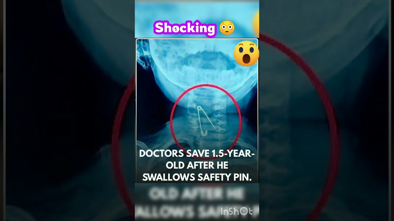 Sh&oslash;cking😳 1.5 years kid &scaron;wallows Safety piň | Surat Gujarat | Ehsaas Kashmir yt shorts feed gulistan