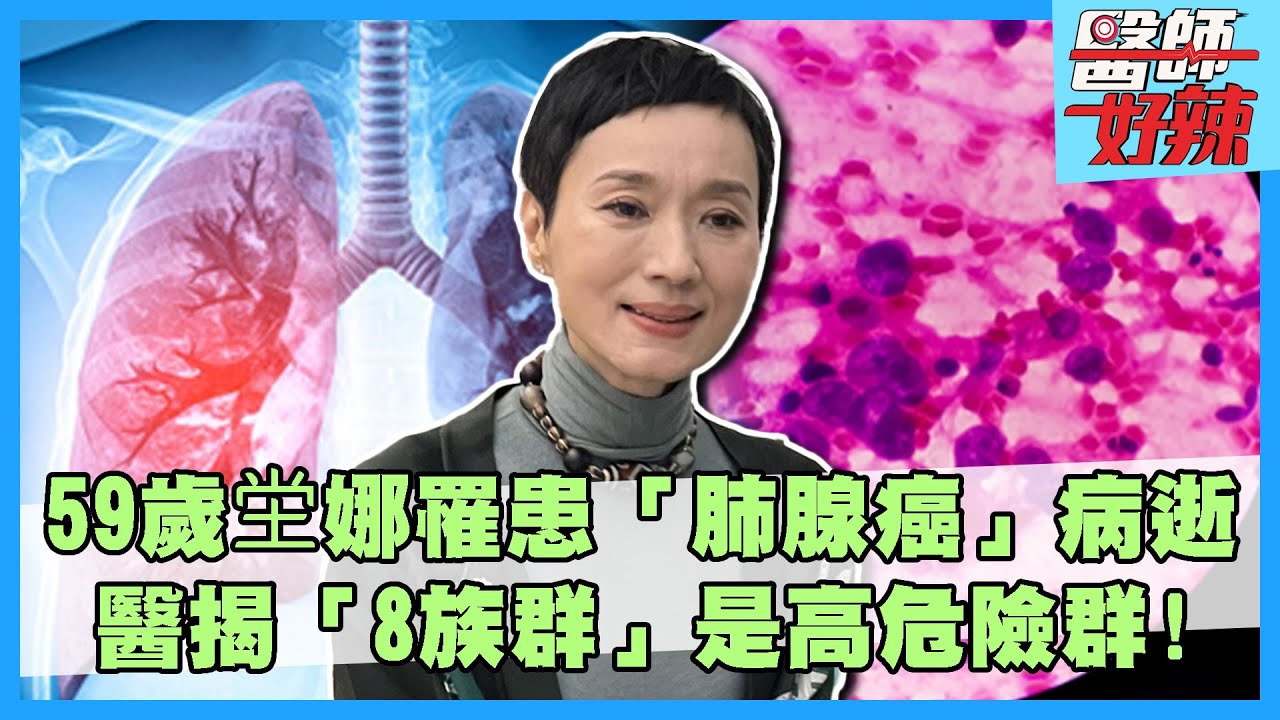 59歲坣娜罹患「肺腺癌」病逝！醫揭「8族群」是高危險群！【#醫師好辣】賈蔚 邱永林 主題特映版