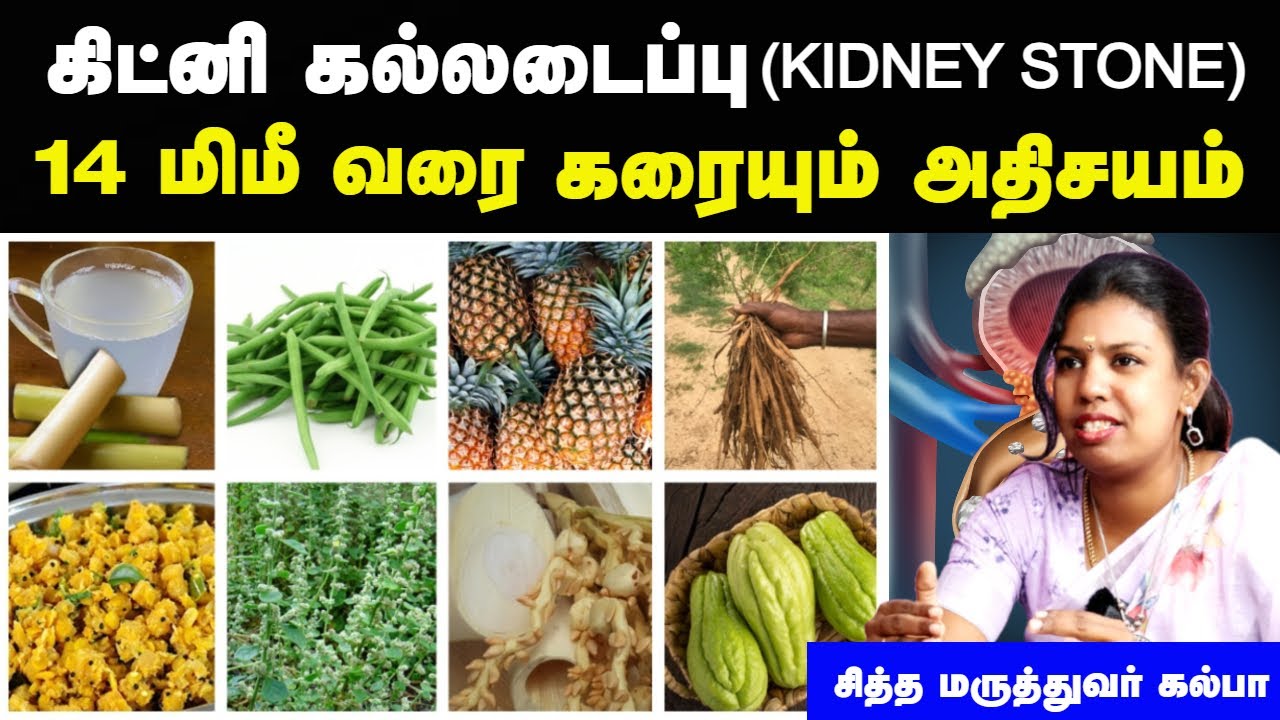 கல்லடைப்பு அறிகுறிகள்  | Kidney stone symptoms in tamil | Kalladaippu arikurikal tamil | Doctor