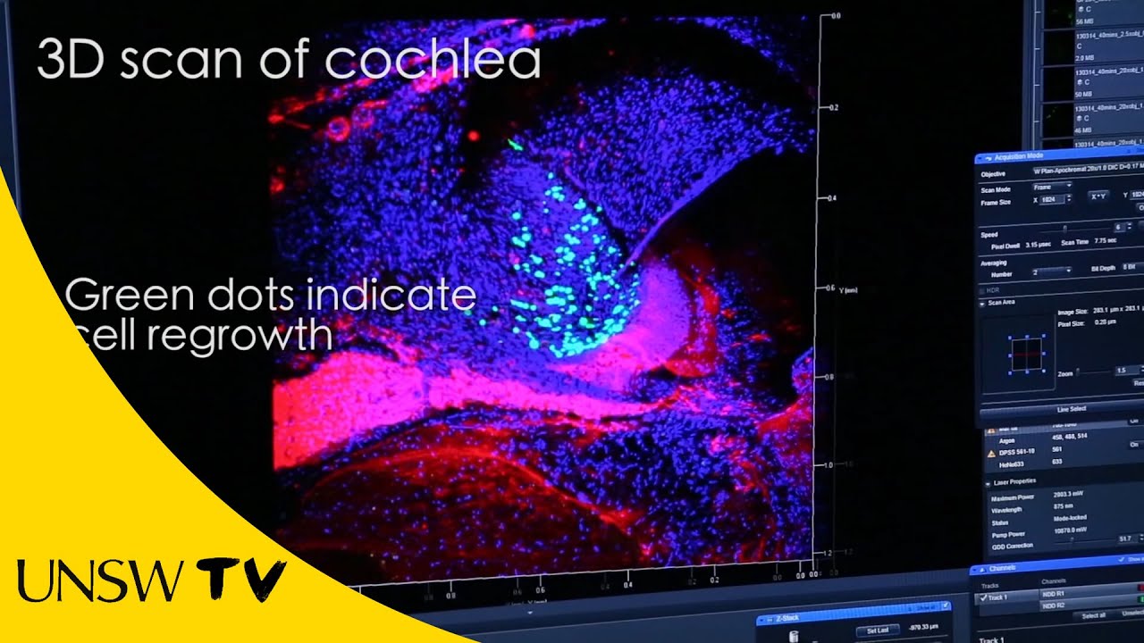 Bionic ear delivers DNA to regrow auditory nerve cells