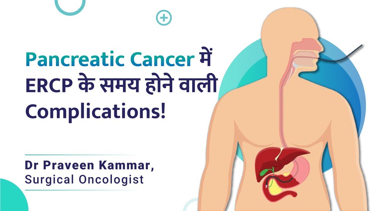 Pancreatic cancer में Jaundice का इलाज करते समय Complications | ERCP in Hindi | Dr Praveen Kammar
