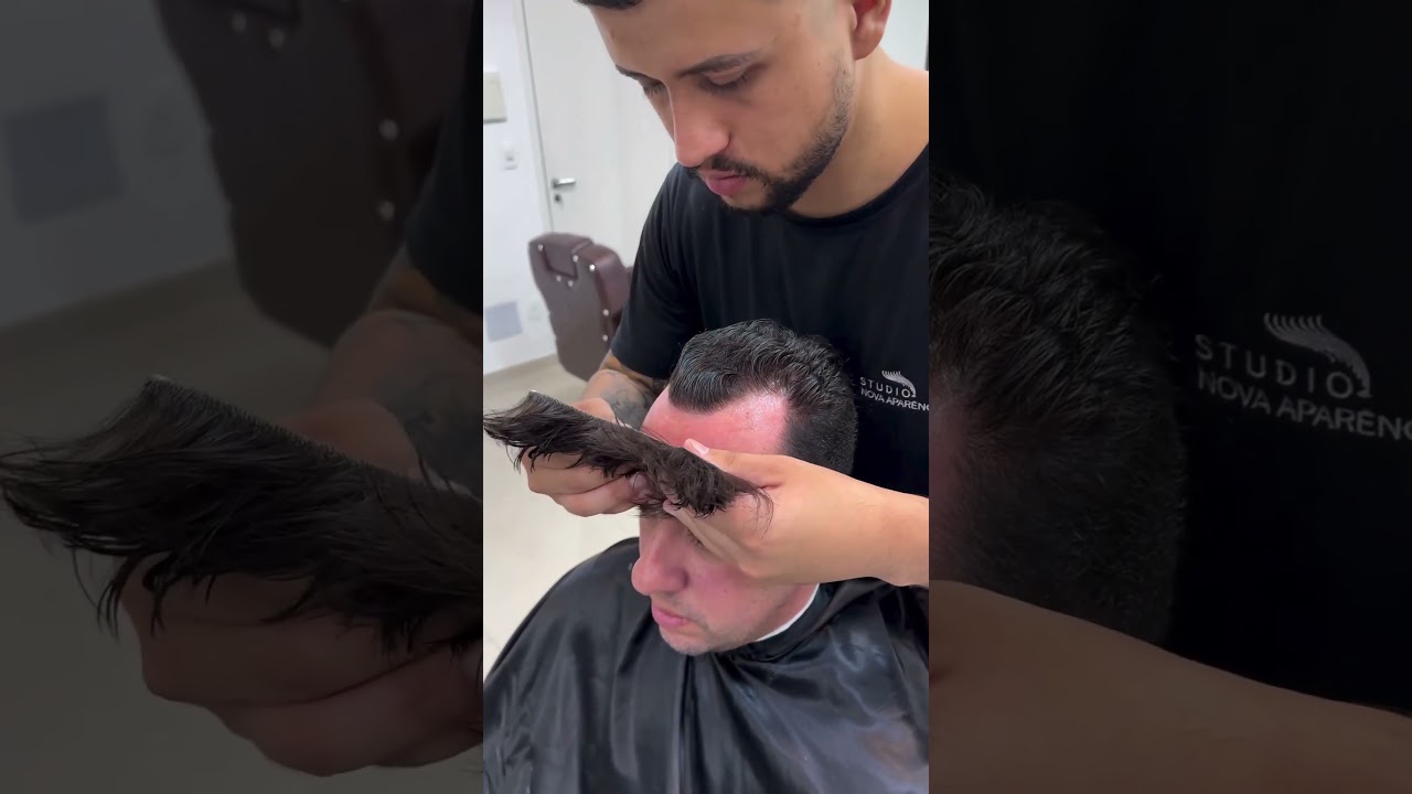 Mini pr&oacute;tese capilar