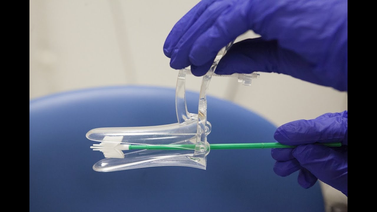 cervical screening Questions