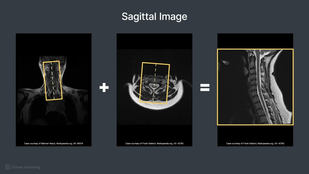 Patient Positioning and Protocol for a Cervical Spine MRI