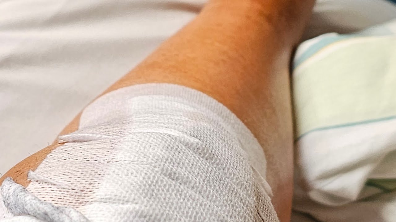 Meine Reha in Bad Nauheim nach Knie-Op