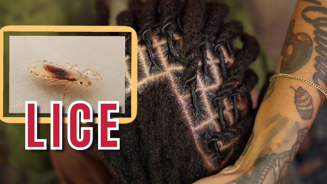 Storytime: LICE in my kid's LOCS