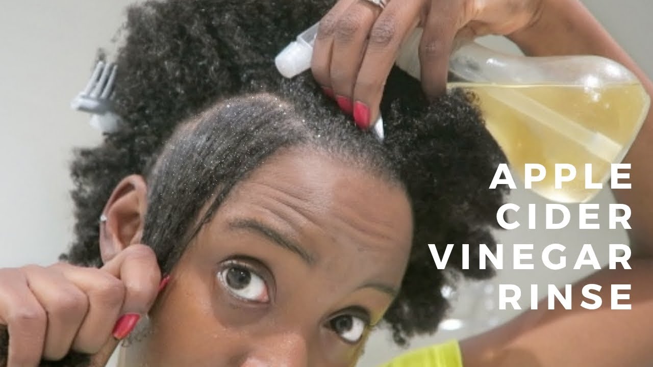 Apple Cider Vinegar Rinse | Dandruff Cure