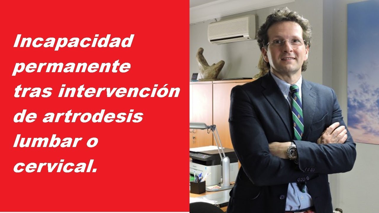 Incapacidad permanente por artrodesis lumbar o cervical.